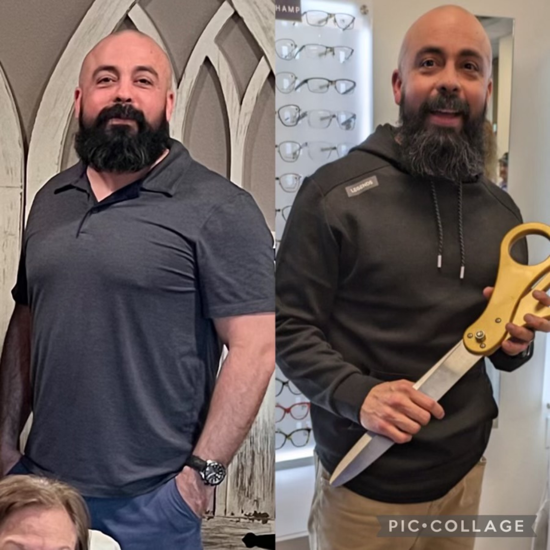 amazing before and after with leanlife llc